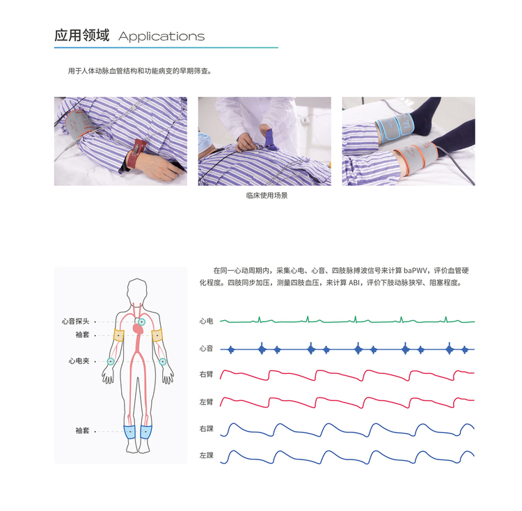 動(dòng)脈硬化檢測(cè)儀KAS6800